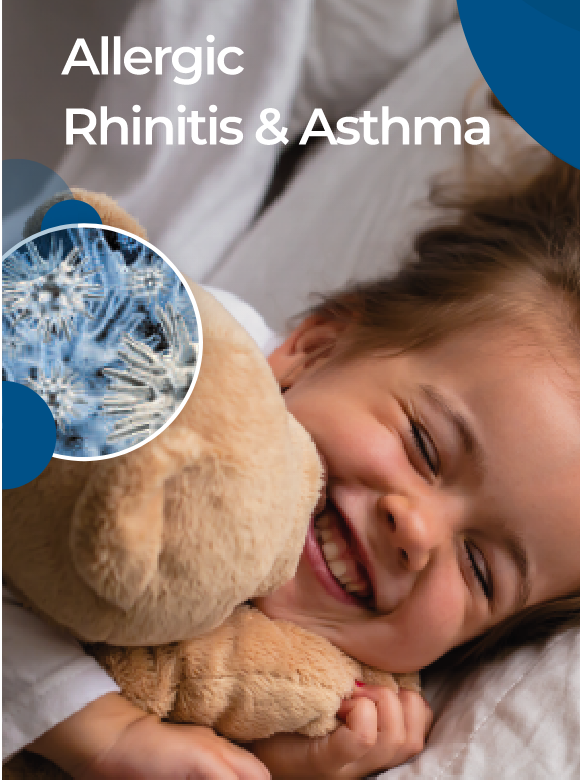 Rinitis alérgica y asma alérgica