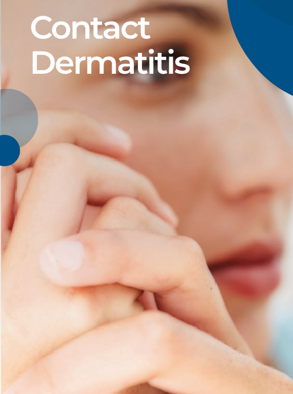Dermatitis de contacto