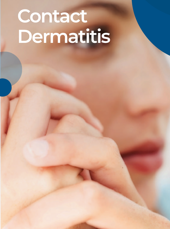 Contact Dermatitis