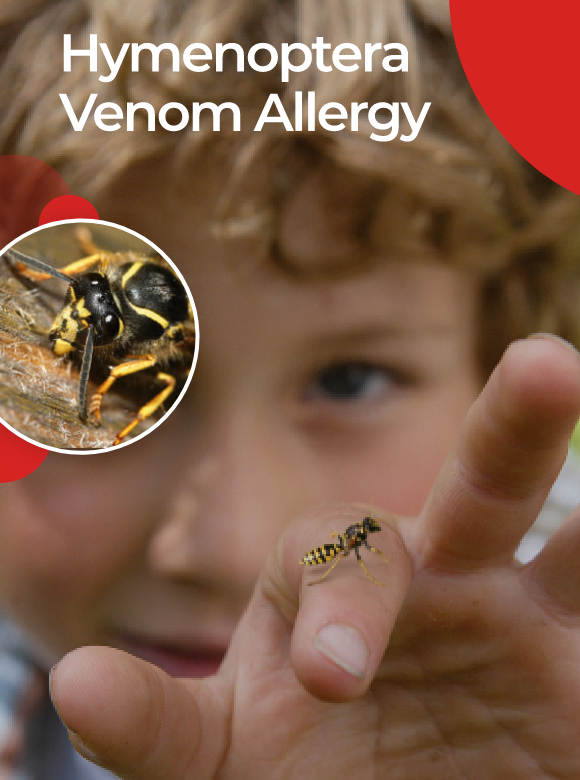 Alergia al veneno de himenópteros